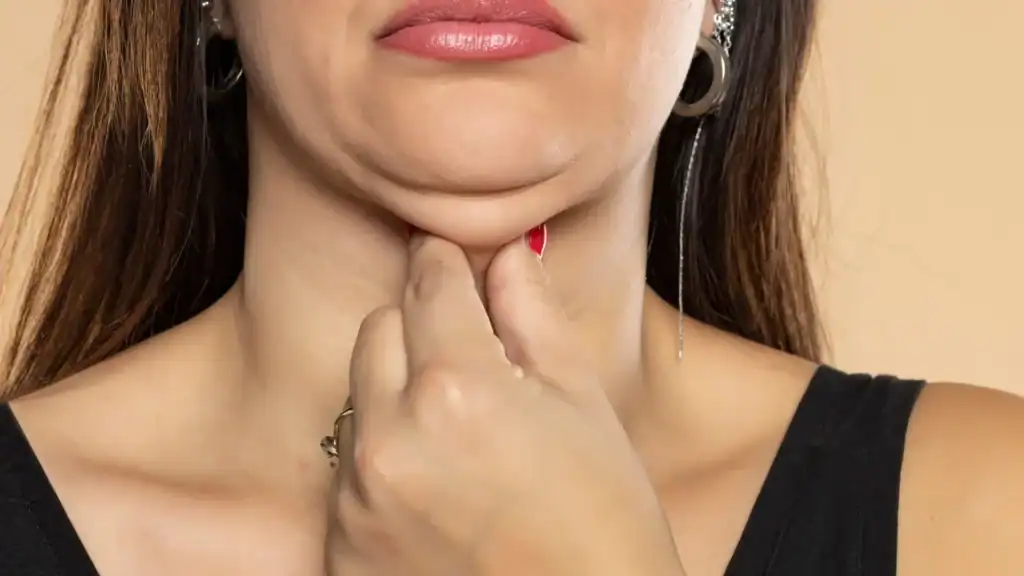 An image of a woman with double chin, sad, worried : Non Surgical Double Chin Removal Treatment in Gloucestershire , UK