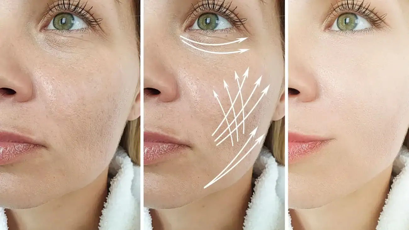 Can One Treatment Really Tackle More Than One Skin Concern Gloucestershire ?