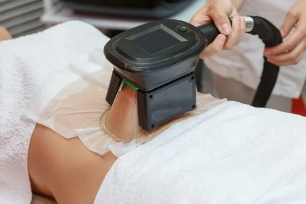 Image of person having fat freezing treatment to help weight gain Gloucestershire