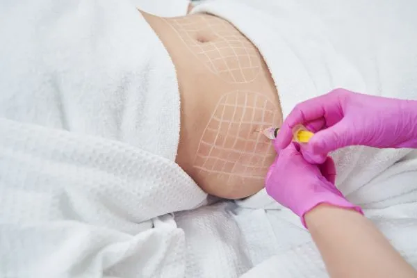 image of fat dissolving injections on love handles to help combat weight gain Gloucestershire
