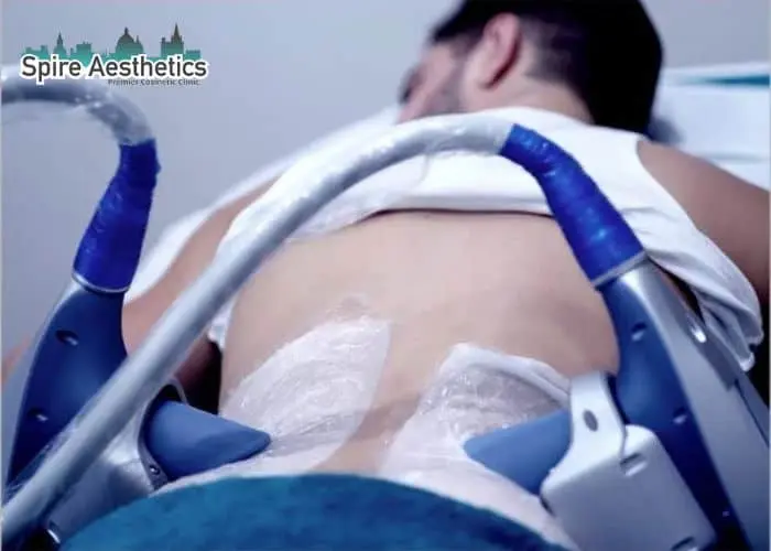 Man having fat freezing treatment done on love handles before a competitions Gloucestershire to create a sculpted look.