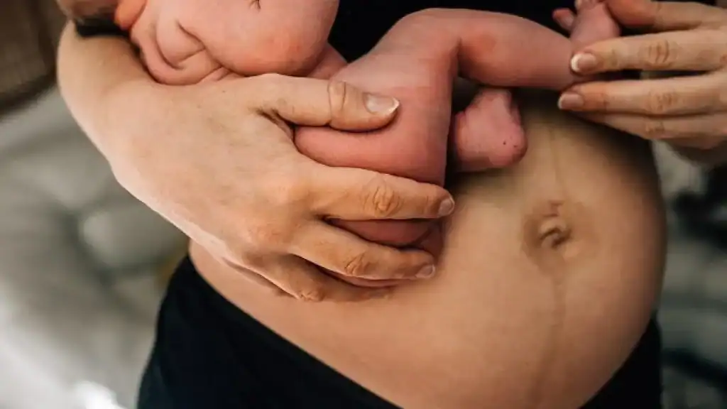 Why Is My Stomach Still Big After Pregnancy Gloucestershire ?