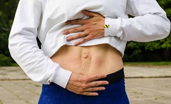 When Could Diastasis Recti Be the Missing Piece of the Puzzle Gloucestershire ?